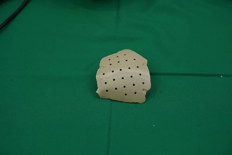 Mảnh ghép hộp sọ PEEK